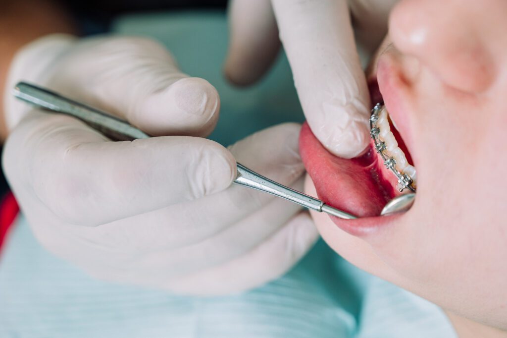 Revisión dental de ortodoncia con brackets metálicos por especialista