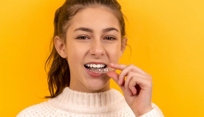 Mujer joven usando alineadores Invisalign, alternativa moderna a los brackets